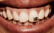piercing no dente